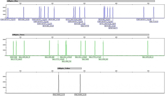 Der Mentype® AMLplexQS identifiziert nicht nur die häufigen, sondern auch die selteneren genetischen Der Mentype® AMLplexQS identifiziert nicht nur die häufigen, sondern auch die selteneren genetischen