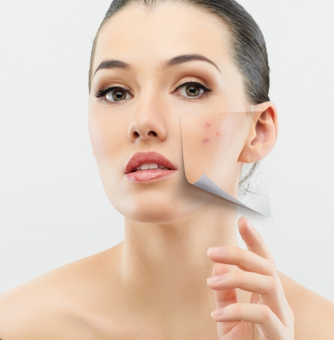Ebenmäßigeres Hautbild während der Wechseljahre  - exklusiv bei DERMA EVE®