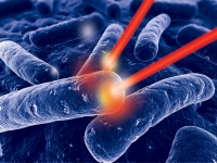 Die HELBO-Therapie von bredent – erfolgreich bei Augmentationen Die HELBO-Therapie von bredent – erfolgreich bei Augmentationen