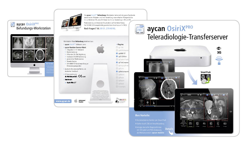 Entdecken Sie die neuen aycan OsiriX PRO Workstation-Pakete. Entdecken Sie die neuen aycan OsiriX PRO Workstation-Pakete.