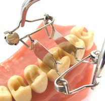 Zahn-Matrize aus dem Teilmatrizensystem von Dr. Walser Dental/Foto: Dr. Walser Dental GmbH Zahn-Matrize aus dem Teilmatrizensystem von Dr. Walser Dental/Foto: Dr. Walser Dental GmbH