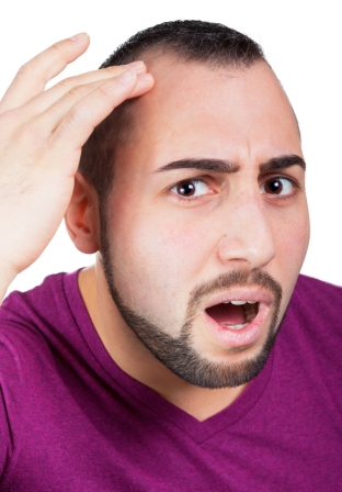Auch viele junge Männer sind schon von Haarausfall betroffen Auch viele junge Männer sind schon von Haarausfall betroffen