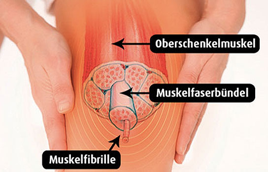 Muskelkater: Was tun gegen die Schmerzen? Muskelkater: Was tun gegen die Schmerzen?