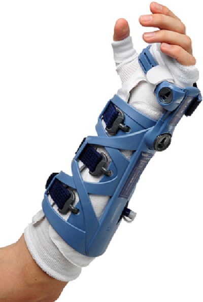 VACOhand RADIUS bei Distorsionen des Handgelenks