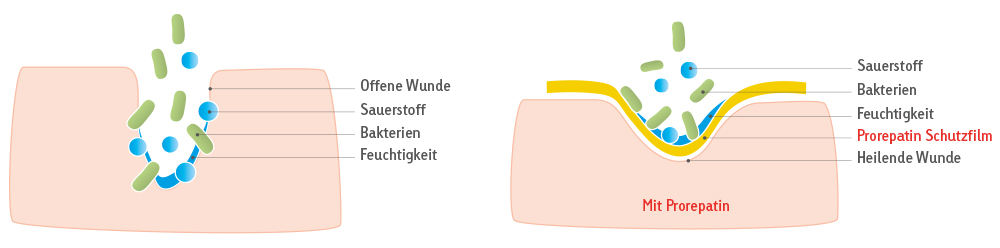 Das Wirkprinzip von Prorepatin Das Wirkprinzip von Prorepatin