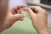 Modell zum neuen Implantationsverfahren. Foto: Klinik am Schloss Modell zum neuen Implantationsverfahren. Foto: Klinik am Schloss