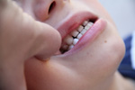 Tag der Zahngesundheit (c) Claudia Heck_pixelio
