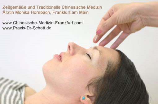 Behandlung des Reizdarm-Syndroms mit Methoden der chinesische Medizin und Akupunktur.