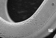 Poröser Stent mit Wirkstoffdepot